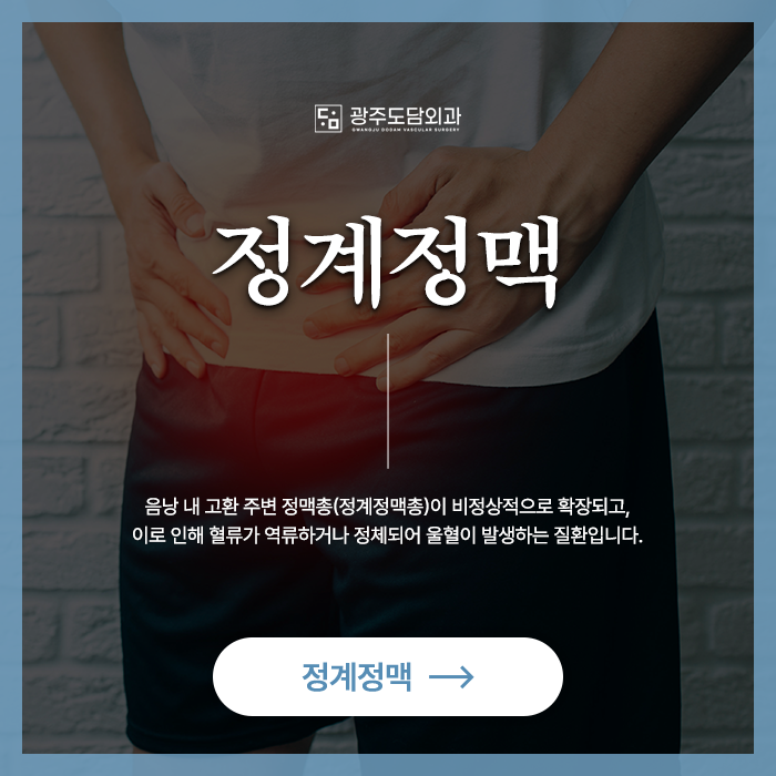 광주 서구 정계정맥류 광주도담외과