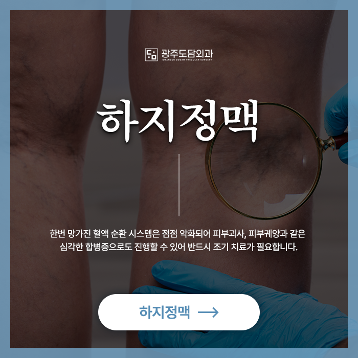 광주 서구 하지정맥류 수술 치료 광주도담외과